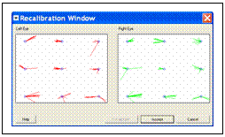 Fairly poor calibration, with inaccuracy caused by nystagmus