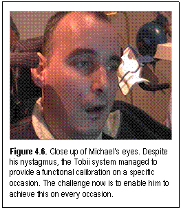 Figure 4.6. Close up of Michael's eyes. Despite his nystagmus, the Tobii system managed to provide a functional calibration on a specific occasion. The challenge now is to enable him to achieve this on every occasion.