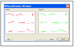 Very poor calibration, with a lot of inaccuracy caused by nystagmus